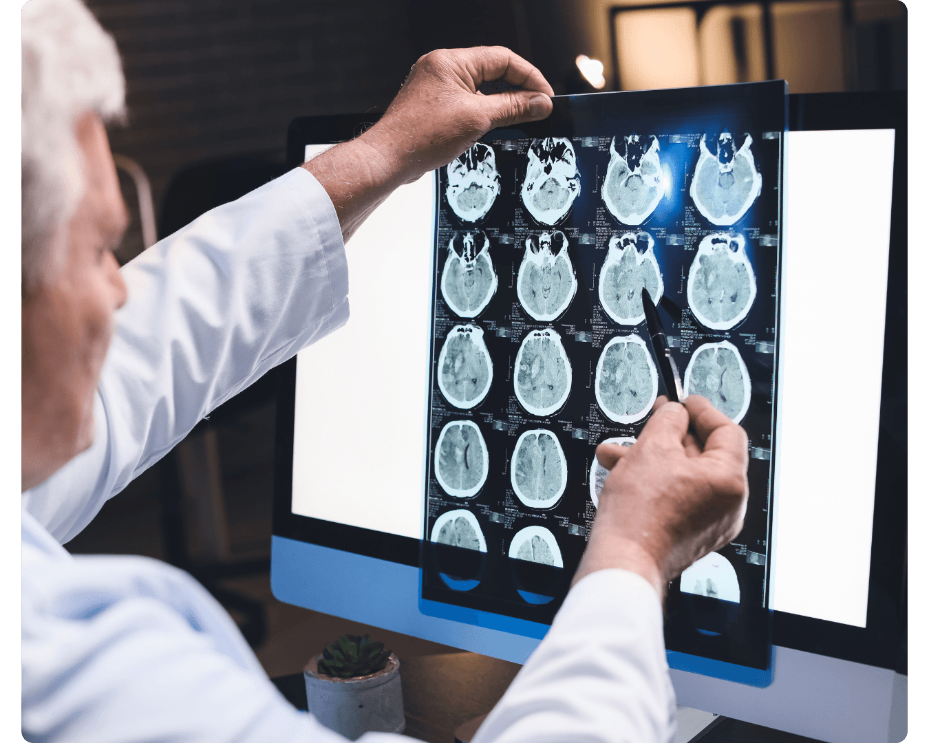 Medical professional reviewing brain scans
